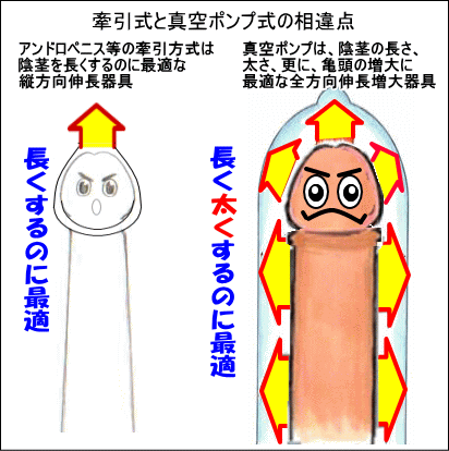 アンドロペニスとミスターハイの比較