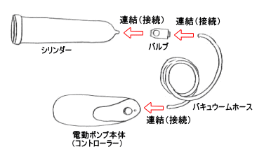 セッティング